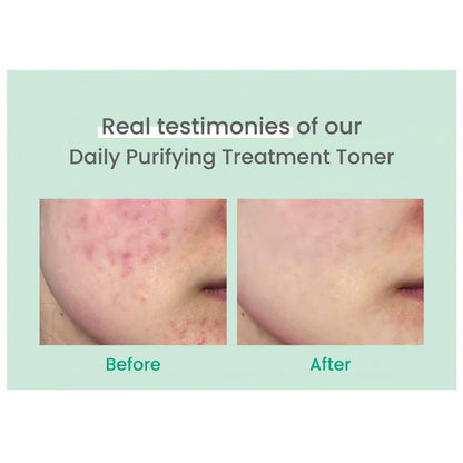 Daily Purifying Treatment Toner