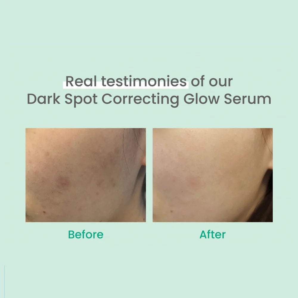 Dark Spot Correcting Glow Serum