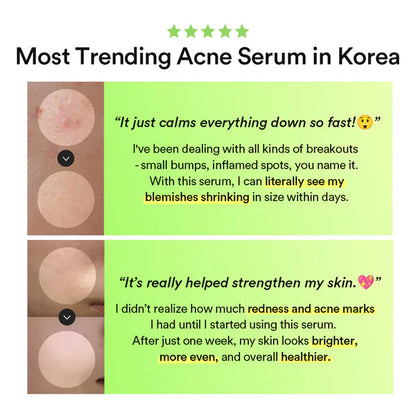 Heartleaf TECA Capsule Serum Calming Drop